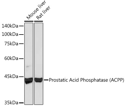 Prostatic Acid Phosphatase (ACPP) Rabbit Monoclonal Antibody