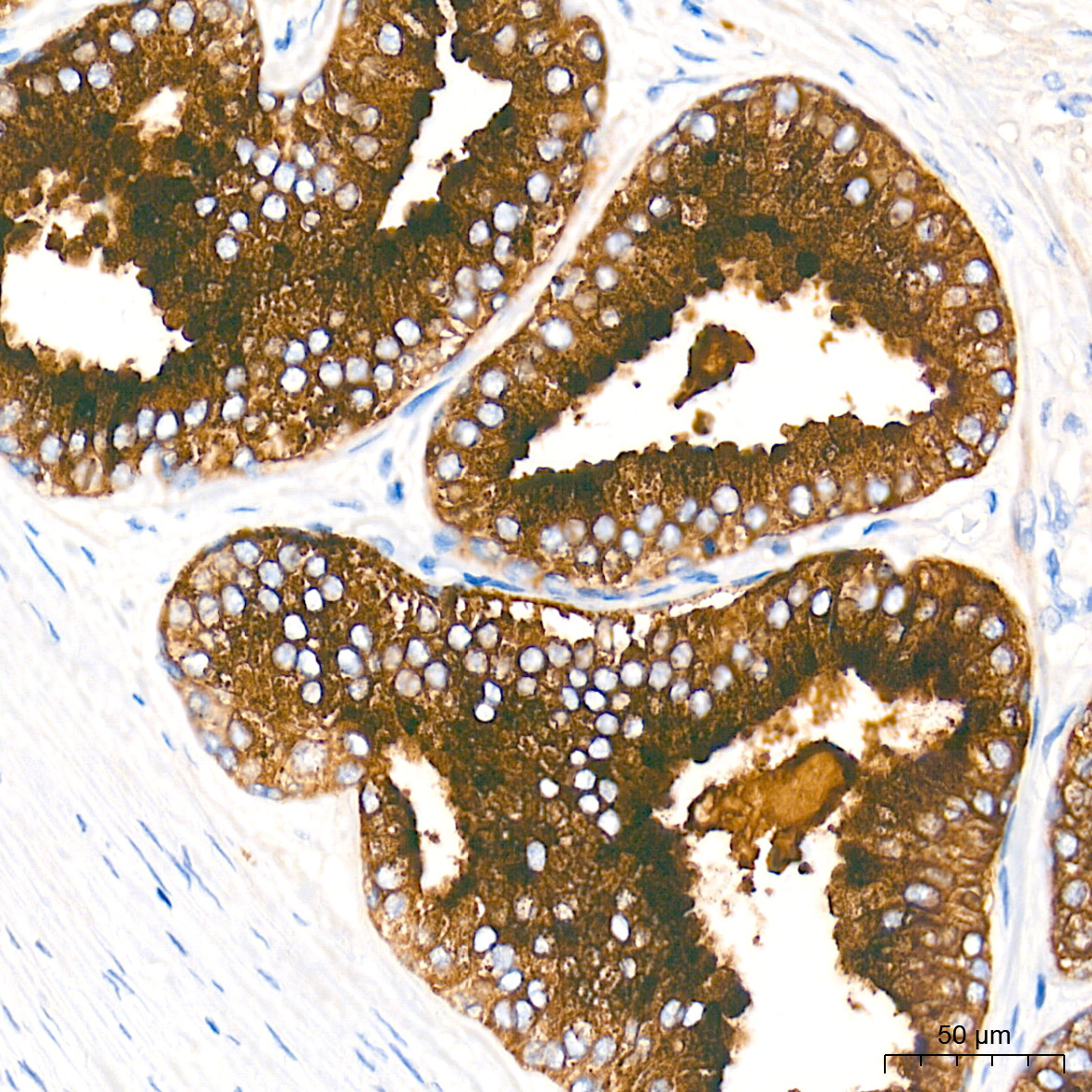 Prostatic Acid Phosphatase (PSAP) Rabbit Monoclonal Antibody - Image 2