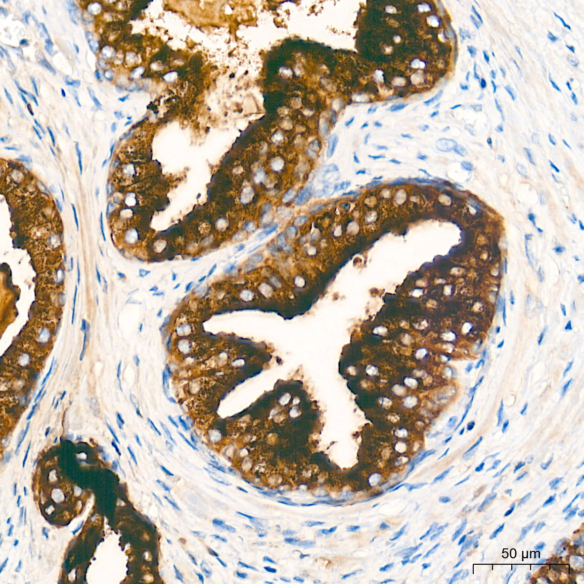 Prostatic Acid Phosphatase (PSAP) Rabbit Monoclonal Antibody - Image 3