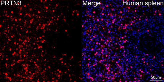 Proteinase 3/PR3 Rabbit Monoclonal Antibody