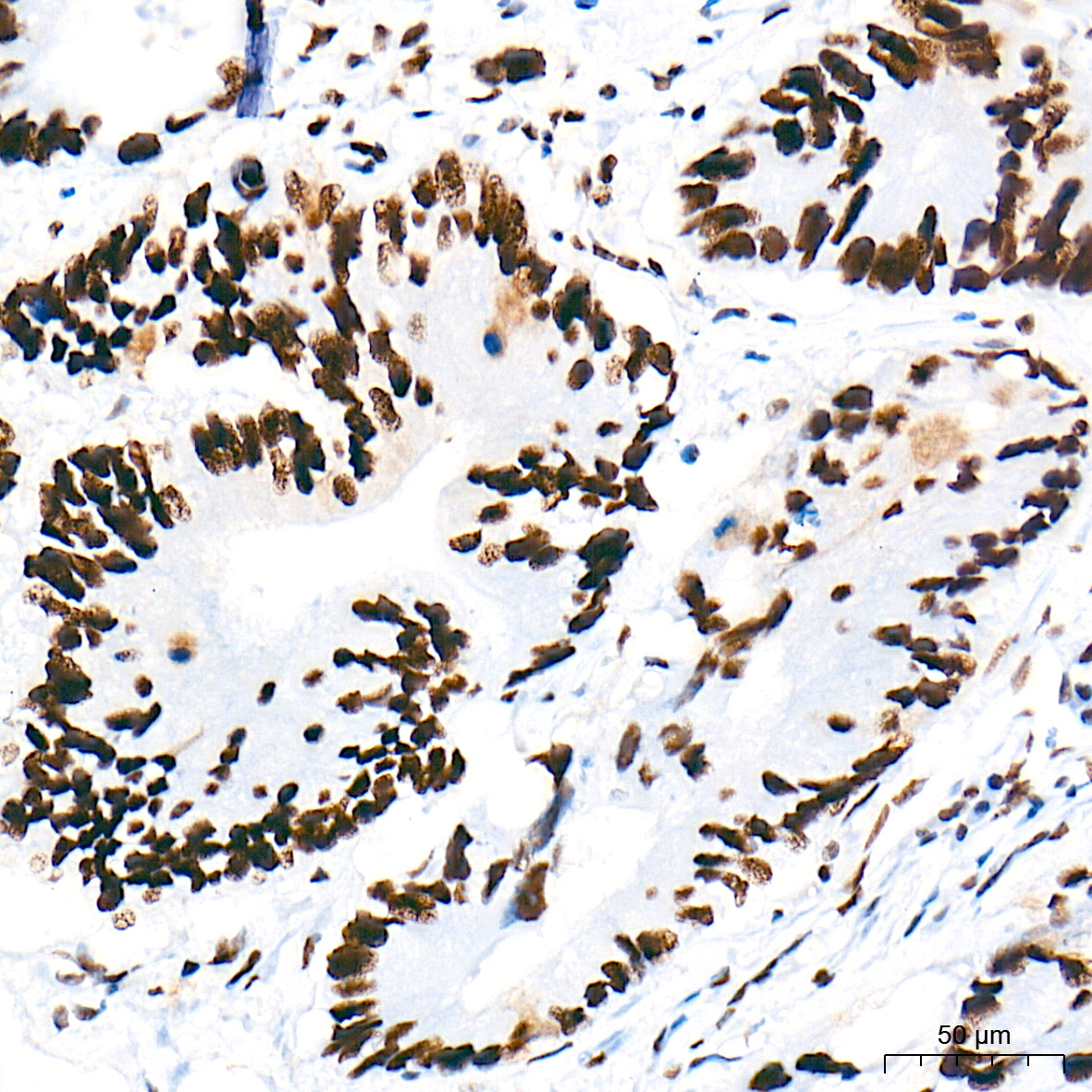 PROX1 Rabbit Monoclonal Antibody