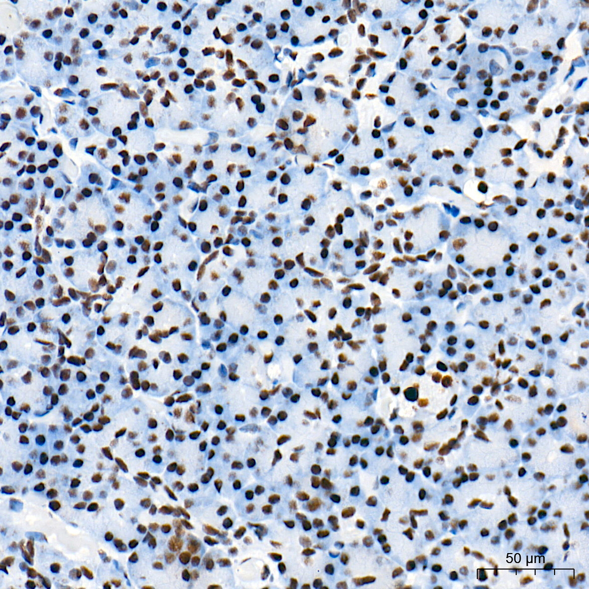 PROX1 Rabbit Monoclonal Antibody - Image 2