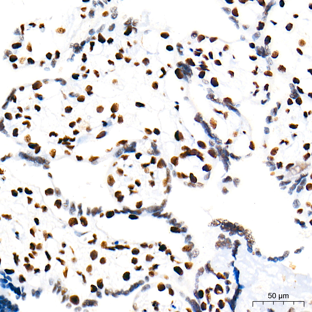 PROX1 Rabbit Monoclonal Antibody - Image 3