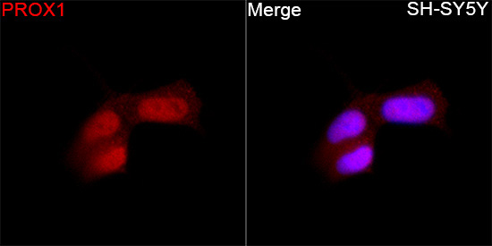PROX1 Rabbit Polyclonal Antibody