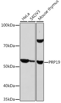 PRP19 Rabbit Monoclonal Antibody