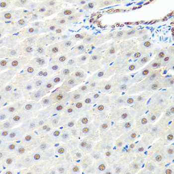 PRP19 Rabbit Polyclonal Antibody - Image 2