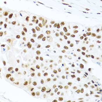 PRP19 Rabbit Polyclonal Antibody - Image 3