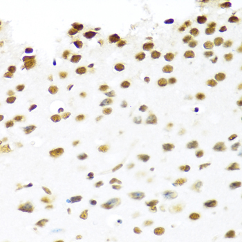 PRP19 Rabbit Polyclonal Antibody - Image 5