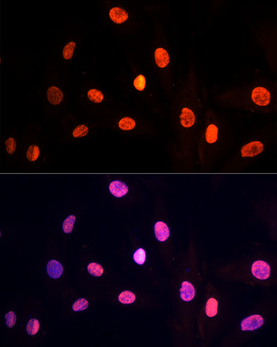 PRP19 Rabbit Polyclonal Antibody - Image 6