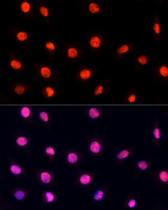 PRP19 Rabbit Polyclonal Antibody - Image 7