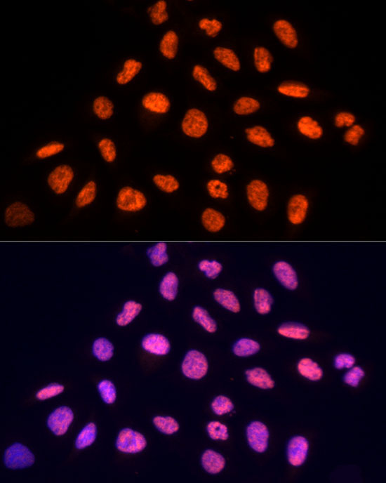 PRP19 Rabbit Polyclonal Antibody - Image 8