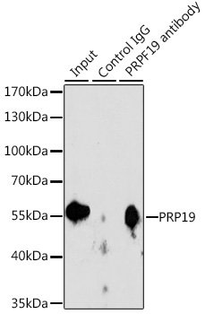 PRP19 Rabbit Polyclonal Antibody - Image 9
