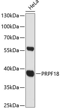 PRPF18 Rabbit Polyclonal Antibody
