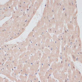 PRPF31 Rabbit Polyclonal Antibody - Image 2