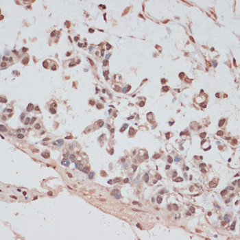 PRPF31 Rabbit Polyclonal Antibody - Image 3