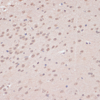 PRPF31 Rabbit Polyclonal Antibody - Image 4