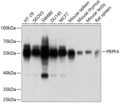 PRPF4 Rabbit Polyclonal Antibody
