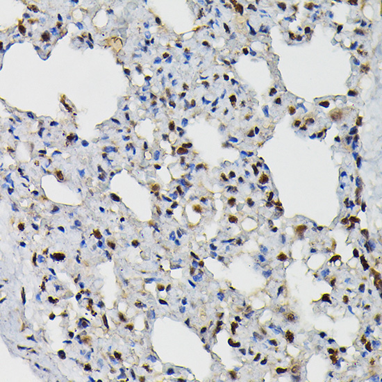 PRPF4 Rabbit Polyclonal Antibody - Image 2