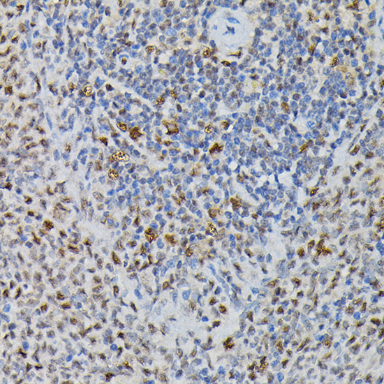 PRPF4 Rabbit Polyclonal Antibody - Image 3