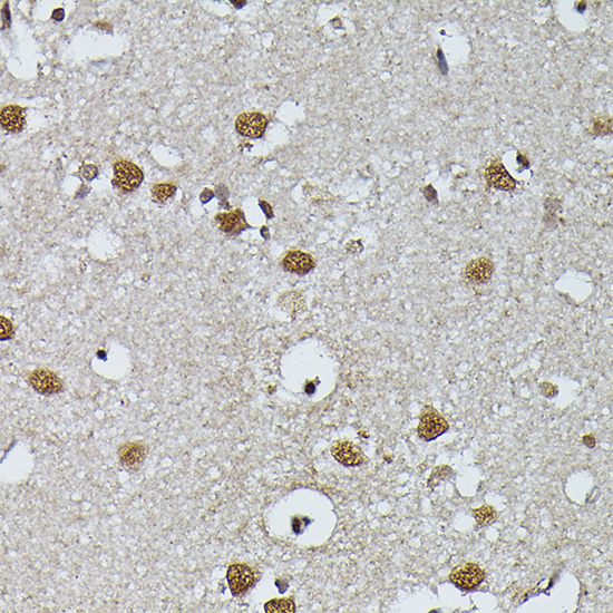 PRPF4 Rabbit Polyclonal Antibody - Image 4