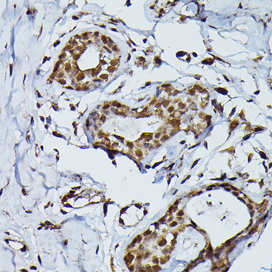 PRPF4 Rabbit Polyclonal Antibody - Image 5