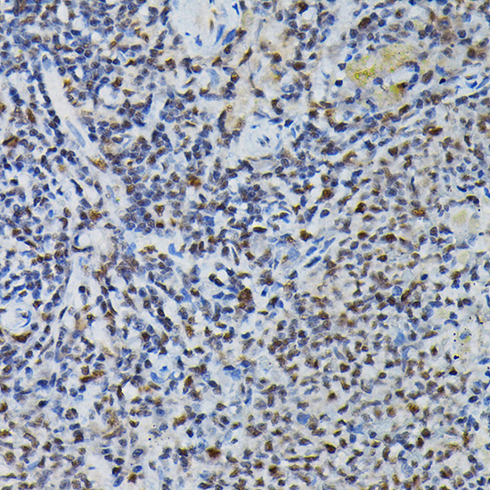 PRPF4 Rabbit Polyclonal Antibody - Image 6