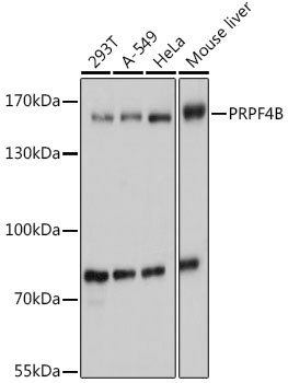 PRPF4B Rabbit Polyclonal Antibody