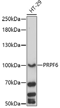PRPF6 Rabbit Polyclonal Antibody