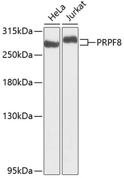 PRPF8 Rabbit Polyclonal Antibody