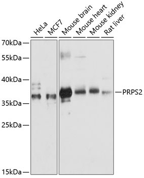 PRPS2 Rabbit Polyclonal Antibody