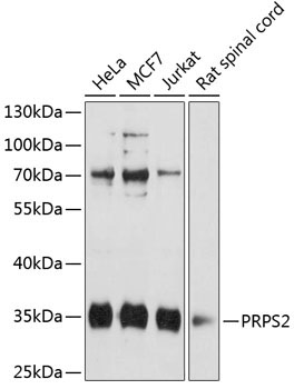 PRPS2 Rabbit Polyclonal Antibody
