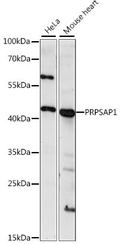 PRPSAP1 Rabbit Polyclonal Antibody