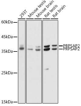 PRPSAP2 Rabbit Polyclonal Antibody