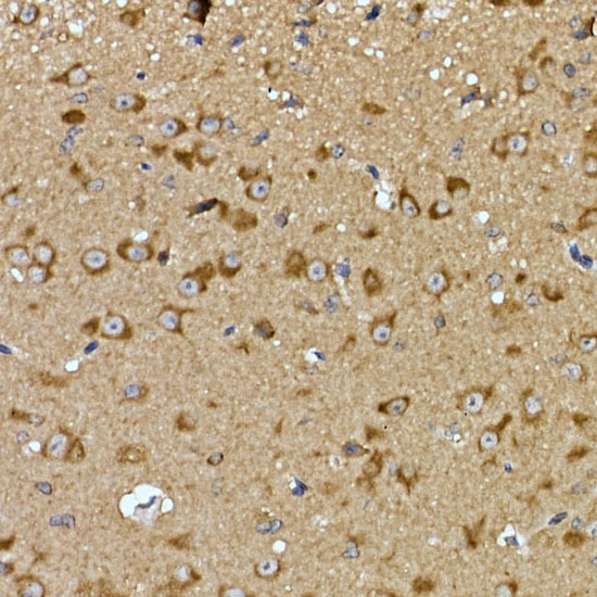 PRPSAP2 Rabbit Polyclonal Antibody - Image 2