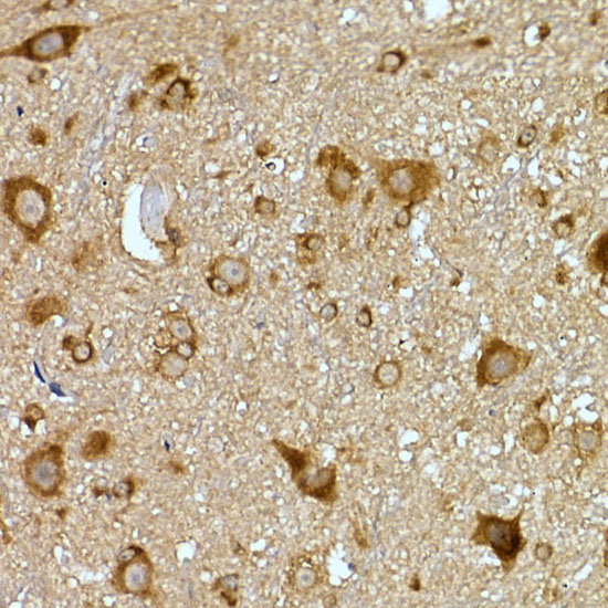 PRPSAP2 Rabbit Polyclonal Antibody - Image 3