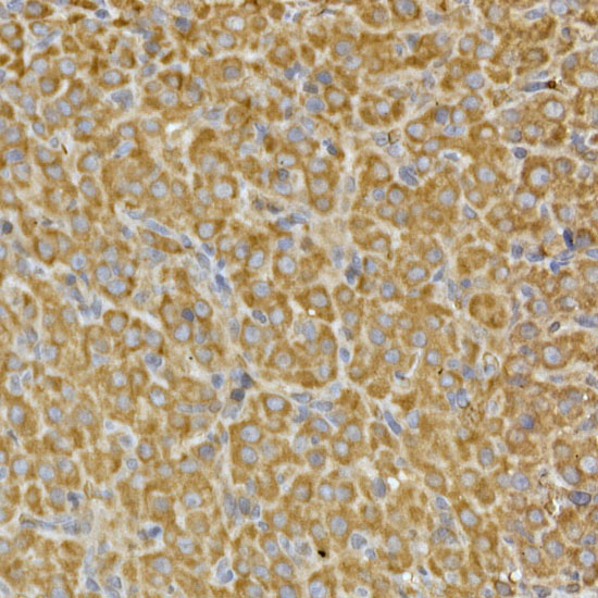 PRPSAP2 Rabbit Polyclonal Antibody - Image 4
