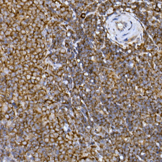 PRPSAP2 Rabbit Polyclonal Antibody - Image 5