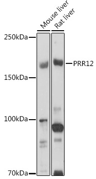 PRR12 Rabbit Polyclonal Antibody