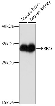 PRR16 Rabbit Polyclonal Antibody
