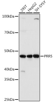 PRR5 Rabbit Polyclonal Antibody