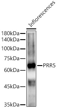 PRR5 Rabbit Polyclonal Antibody