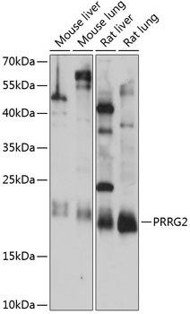 PRRG2 Rabbit Polyclonal Antibody