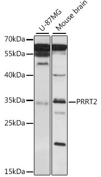 PRRT2 Rabbit Polyclonal Antibody