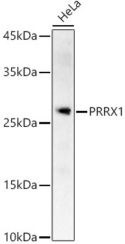PRRX1 Rabbit Polyclonal Antibody