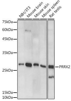 PRRX2 Rabbit Polyclonal Antibody