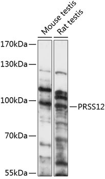 PRSS12 Rabbit Polyclonal Antibody