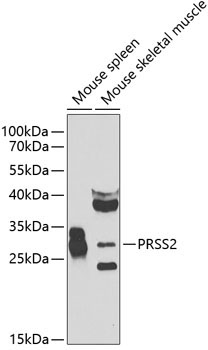 PRSS2 Rabbit Polyclonal Antibody
