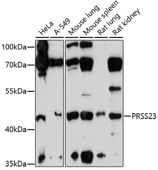 PRSS23 Rabbit Polyclonal Antibody