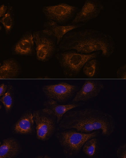 PRSS8 Rabbit Polyclonal Antibody - Image 2