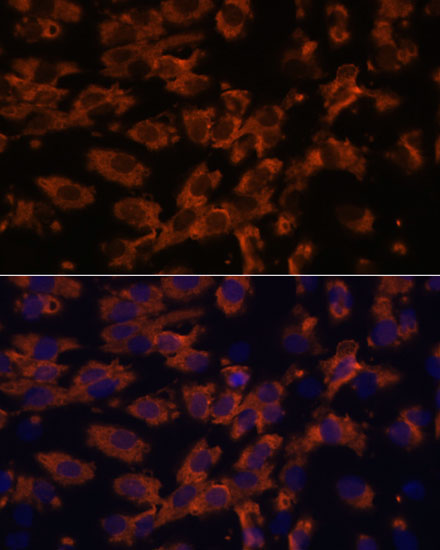 PRX Rabbit Polyclonal Antibody - Image 2